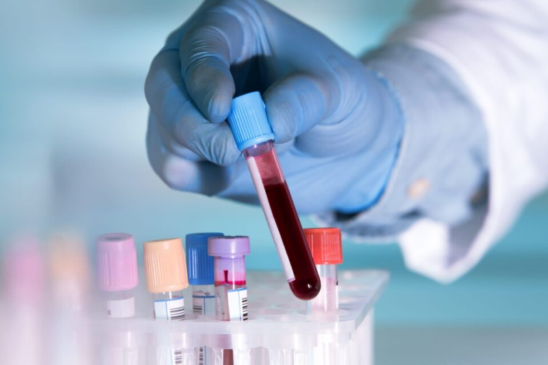 Cancer Blood Tests Move Closer to FDA Approval in a Major Breakthrough for Early Detection